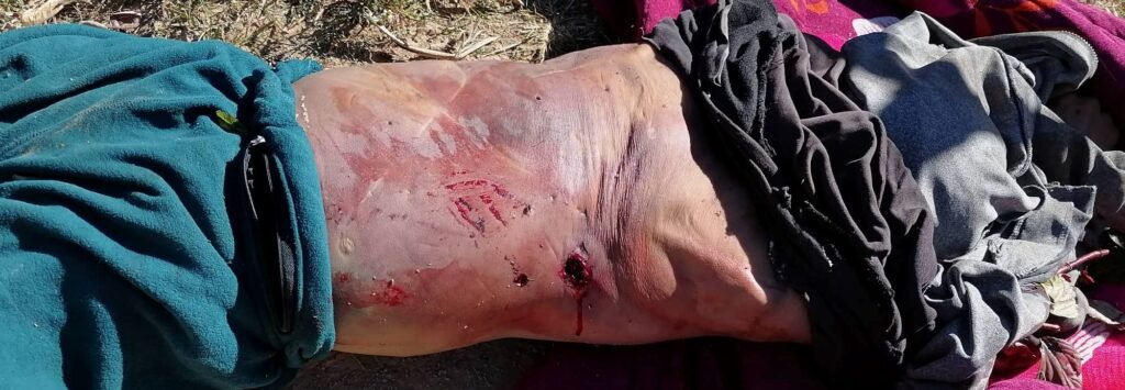 Wounds on his back (Photo: The Rihli Voice)